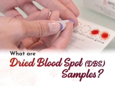Rare diseases : Dried Blood Spot (DBS)